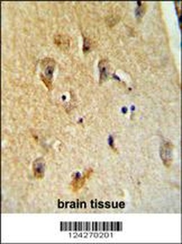 B4GALT6 Antibody