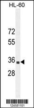 B3GNT4 Antibody