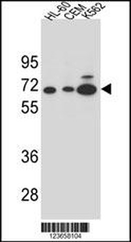 AMY2B Antibody