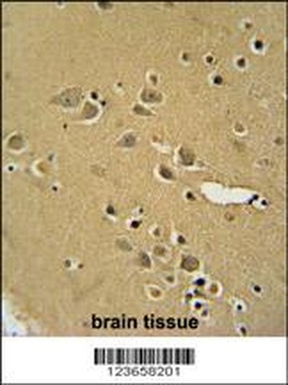 AMY2B Antibody