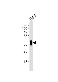 FOLR1 Antibody