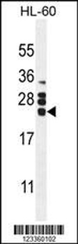 CSF2 Antibody