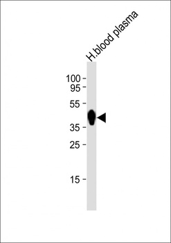 HP Antibody