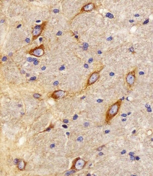 CB2 Antibody