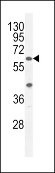 A1CF Antibody