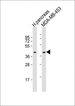 HHLA2 Antibody