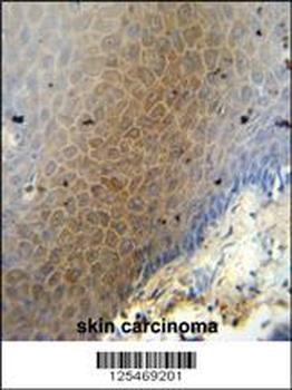 CEP70 Antibody