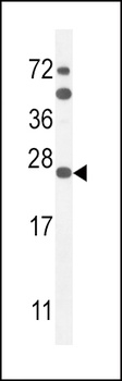 SCN1B Antibody
