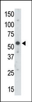 UBA3 Antibody