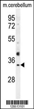 OR51I1 Antibody