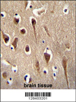 FBXO39 Antibody