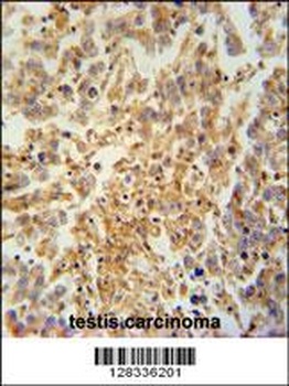 TEX9 Antibody