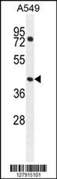 GTPBP8 Antibody