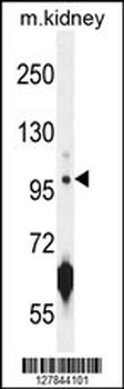 CARNS1 Antibody