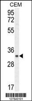 C11orf74 Antibody