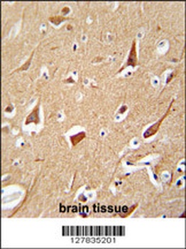 ZFYVE28 Antibody