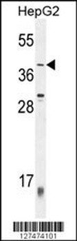 ZNF763 Antibody