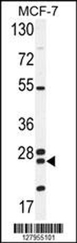 NUDT8 Antibody