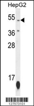ZNF566 Antibody
