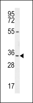 LRRC18 Antibody