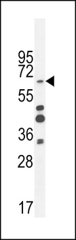 ZNF98 Antibody