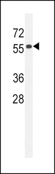 CCDC85C Antibody