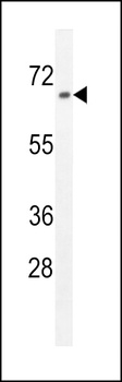 ZNF169 Antibody