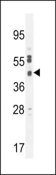 SLC35F6 Antibody