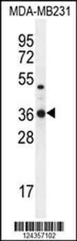 TPSD1 Antibody