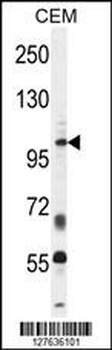 INPP5B Antibody