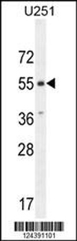 CMKOR1 Antibody