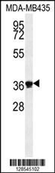 EXO5 Antibody