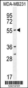 CYP2A7 Antibody