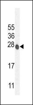 ATP6V0C Antibody