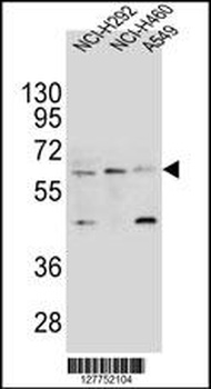 LILRA2 Antibody