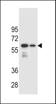 CHST3 Antibody