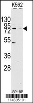 JHDM1a/FBXL11 Antibody