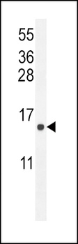 ATP6V0B Antibody