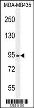 ZBBX Antibody