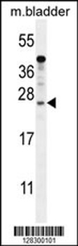 KIAA1644 Antibody