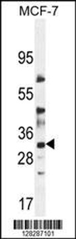 LYSMD4 Antibody