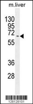 KY Antibody