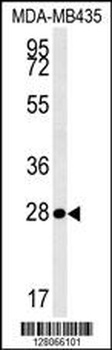 MRM1 Antibody