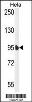 EFTUD1 Antibody