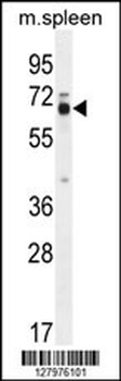 LMOD2 Antibody