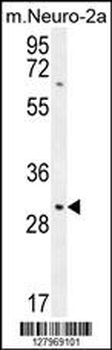 TMEM65 Antibody