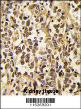DNMT3A Antibody