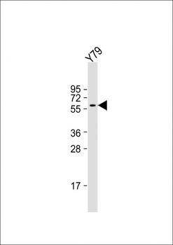 SLC5A12 Antibody