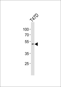 HOXA10 Antibody