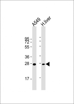 NNMT Antibody